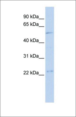 Anti-TFDP1 antibody produced in rabbit