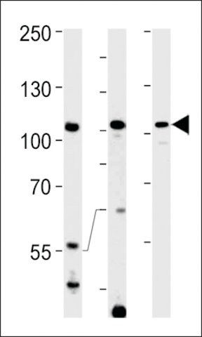 ANTI-TFIP11(N-TERMINAL) antibody produced in rabbit