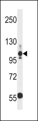 ANTI-THBS3(N-TERMINAL) antibody produced in rabbit