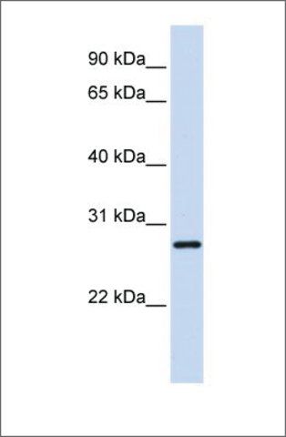 Anti-TGIF2LX (ab1) antibody produced in rabbit