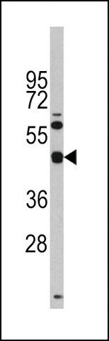 ANTI-TGIF (CENTER L223) antibody produced in rabbit