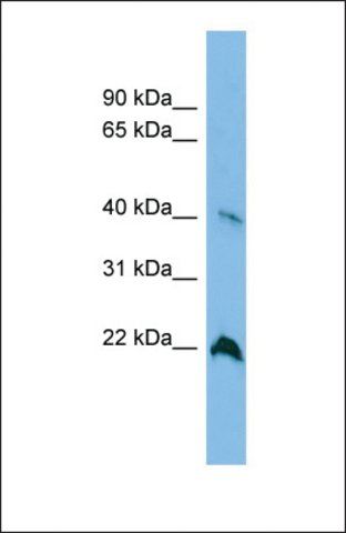 Anti-TGDS antibody produced in rabbit