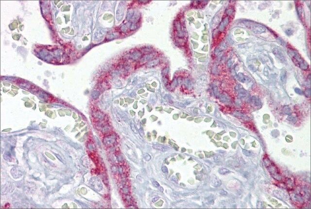 Anti-TFAM antibody produced in rabbit