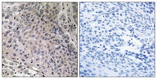 Anti-TEBP antibody produced in rabbit