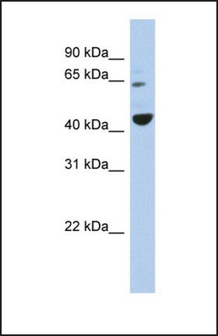 Anti-TFE3 antibody produced in rabbit