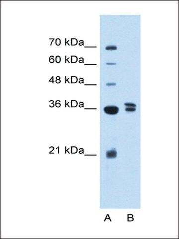 Anti-TFB1M antibody produced in rabbit