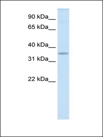 Anti-Tgifx1 antibody produced in rabbit