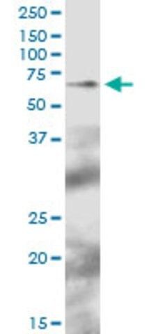 Anti-TFCP2 antibody produced in mouse