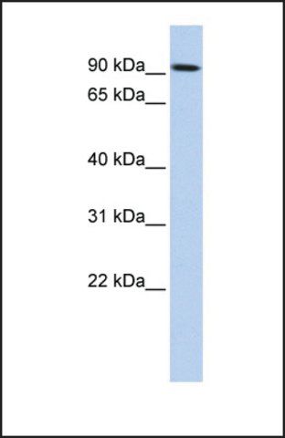 Anti-TGM1, (N-terminal) antibody produced in rabbit