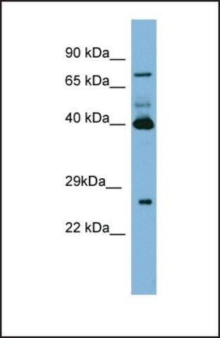 Anti-TGM3 antibody produced in rabbit