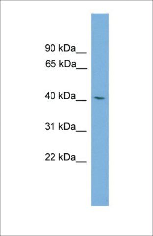 Anti-TFDP3 antibody produced in rabbit