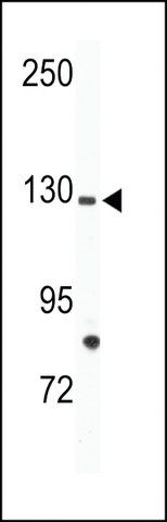 ANTI-TIE(N-TERMINAL) antibody produced in rabbit