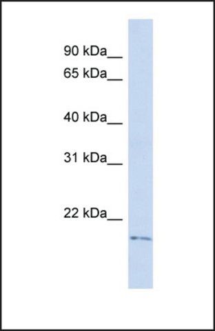 Anti-TGIF2LY antibody produced in rabbit