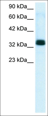 Anti-TIAL1 antibody produced in rabbit