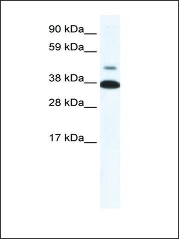 Anti-THRB (ab2) antibody produced in rabbit