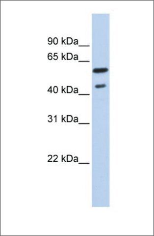 Anti-THRB (ab2) antibody produced in rabbit