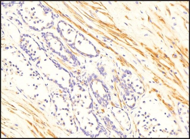 Anti-TGM4, (N-terminal) antibody produced in rabbit