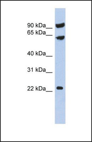 Anti-TIGD3 antibody produced in rabbit