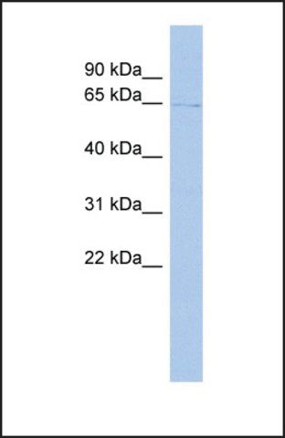 Anti-TIGD1 antibody produced in rabbit