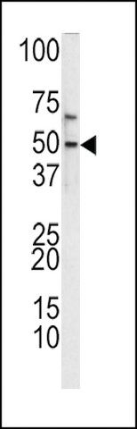 ANTI-TIEG2(N-TERMINAL) antibody produced in rabbit