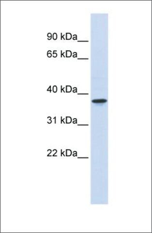 Anti-THOC6 antibody produced in rabbit