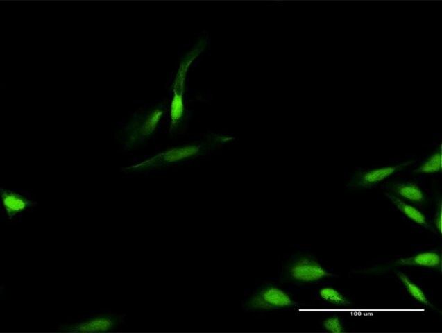 Anti-TIMELESS antibody produced in rabbit