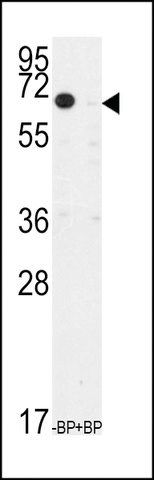 ANTI-TIEG(N-TERMINAL) antibody produced in rabbit