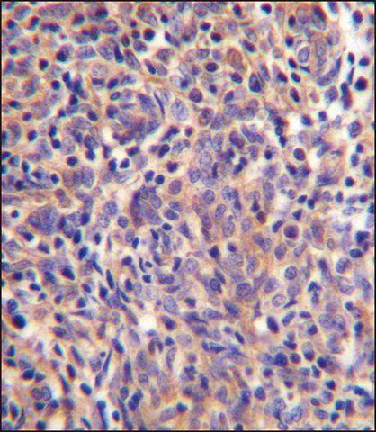 ANTI-THEMIS (C-TERM) antibody produced in rabbit