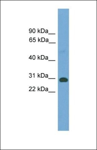 Anti-Tgifx1 antibody produced in rabbit