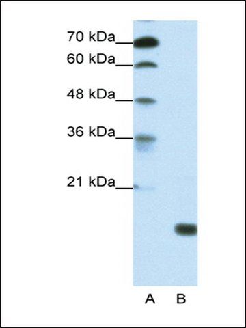 Anti-TGIF2LY antibody produced in rabbit