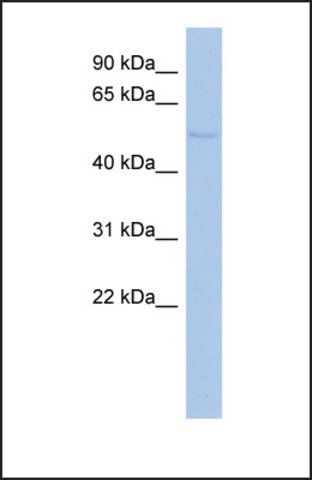 Anti-TIGD4, (N-terminal) antibody produced in rabbit