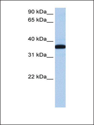 Anti-THEX1 antibody produced in rabbit