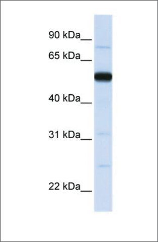 Anti-THUMPD2 antibody produced in rabbit