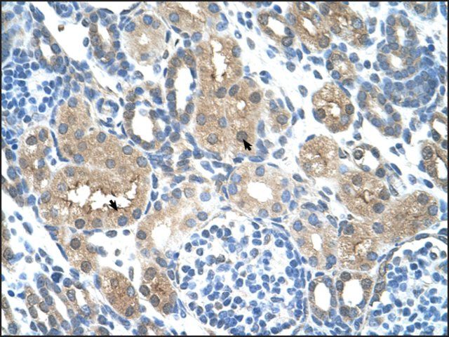 Anti-TLR6 antibody produced in rabbit