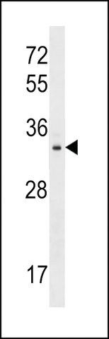 ANTI-TIGAR(N-TERMINAL) antibody produced in rabbit