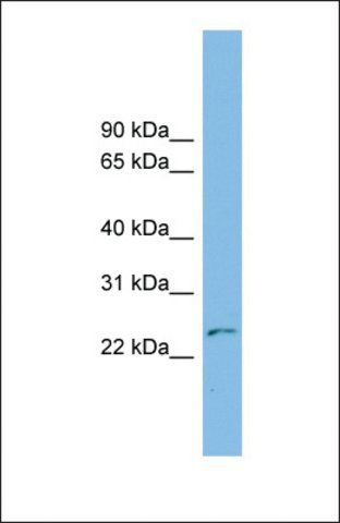 Anti-THYN1, (N-terminal) antibody produced in rabbit