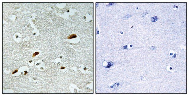 Anti-TIP60 antibody produced in rabbit