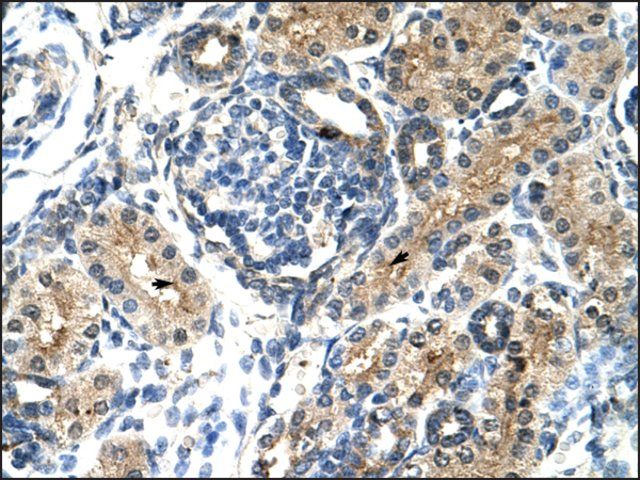 Anti-TIMELESS antibody produced in rabbit