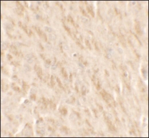 Anti-TLX2 antibody produced in rabbit