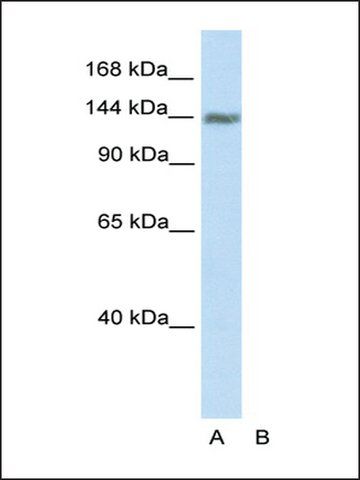 Anti-TIMELESS (AB2) antibody produced in rabbit