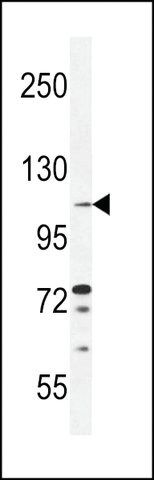 ANTI-TLL2 (CENTER) antibody produced in rabbit