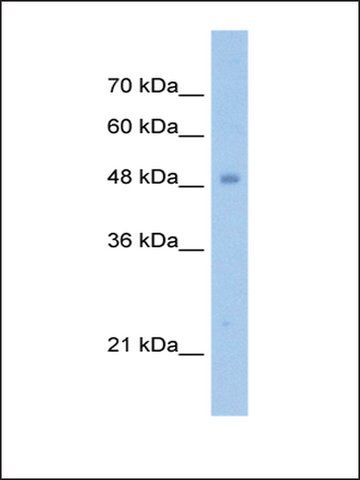 Anti-TIGD3 antibody produced in rabbit