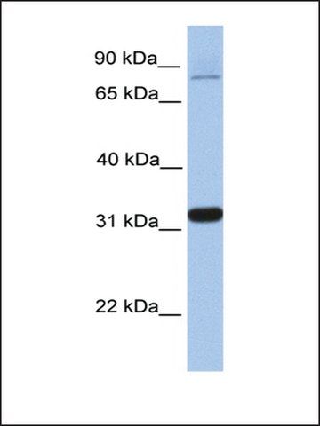 Anti-TIPIN (AB1) antibody produced in rabbit