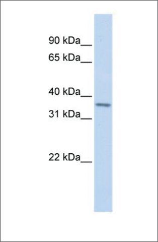 Anti-TLX1 (ab2) antibody produced in rabbit