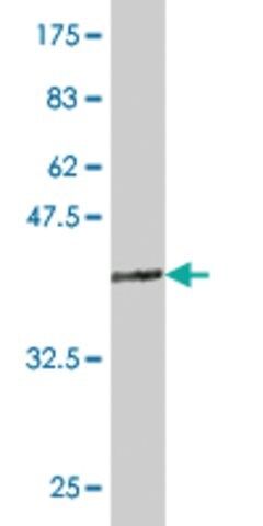 ANTI-TLX3 antibody produced in mouse