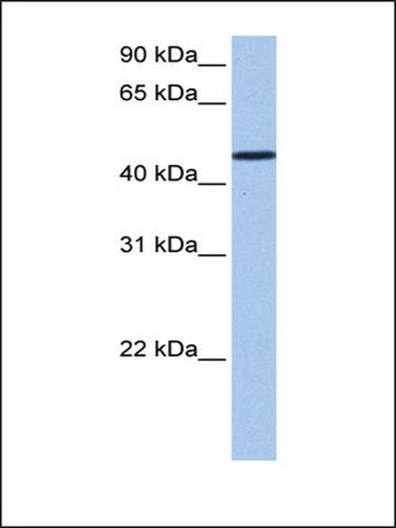 Anti-SAMD14 antibody produced in rabbit