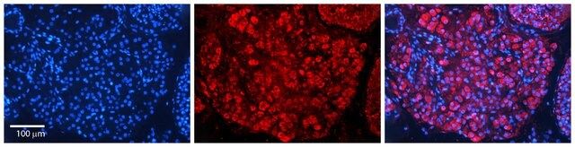 Anti-SAP18 antibody produced in rabbit