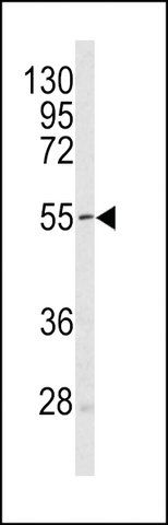 ANTI-SESTRIN-1(C-TERMINAL) antibody produced in rabbit