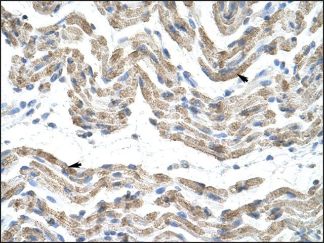 Anti-SFRS10 (AB2) antibody produced in rabbit