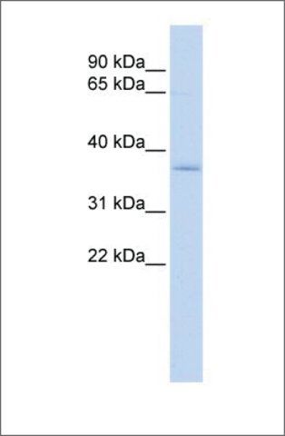 Anti-SFXN3 antibody produced in rabbit